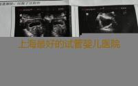 上海最好的试管婴儿医院排名,上海试管供卵助孕机构